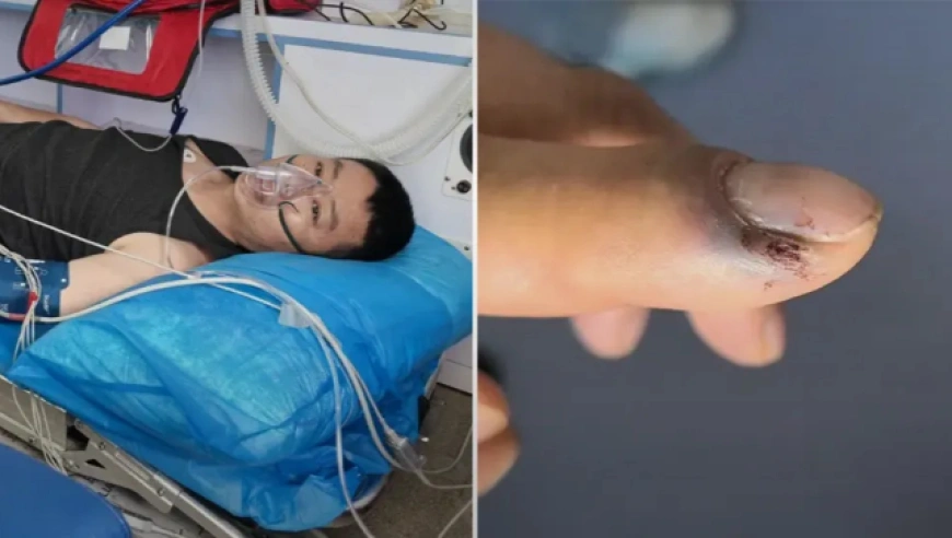 青海大柴旦男子被毒蛇咬伤，警车开道护送700公里救治