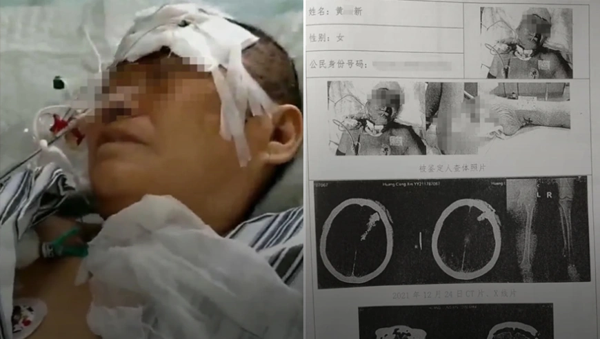 湖北咸宁老人被误伤：从过失到故意？家属申诉背后的法律争议