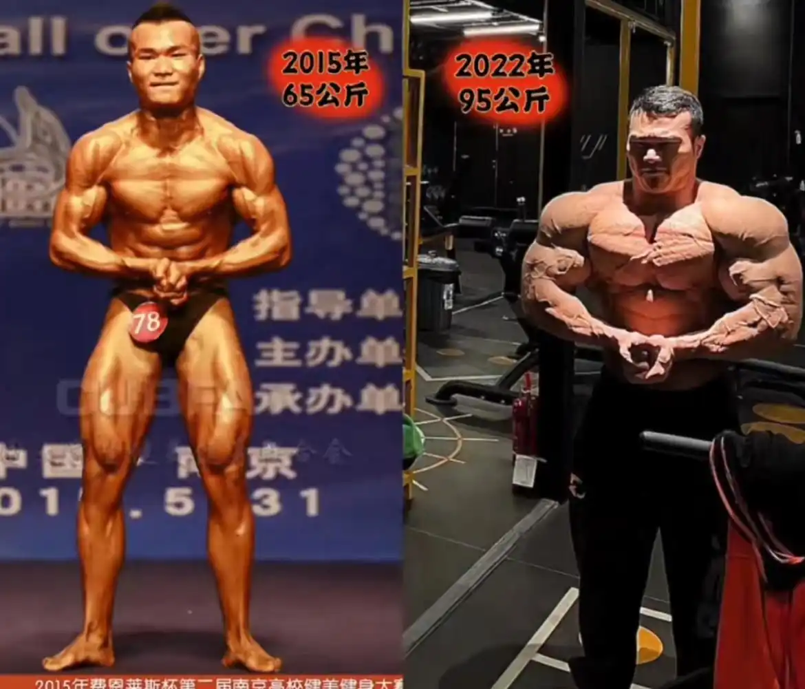 安徽健身博主王昆去世原因_健美类固醇危害_山东健美冠军被打死